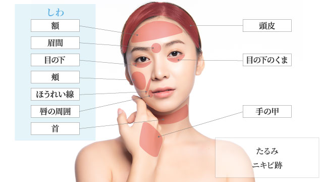 PRP皮膚再生療法施術部位